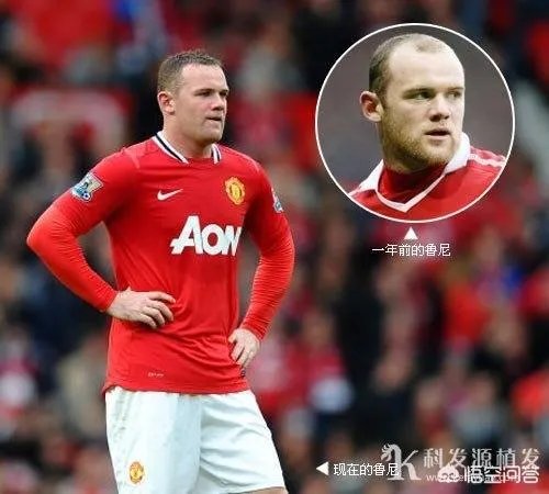 鲁尼植发大概花了多少钱？