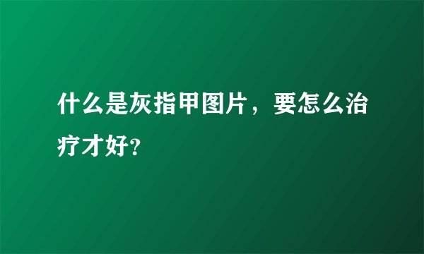 什么是灰指甲图片，要怎么治疗才好？