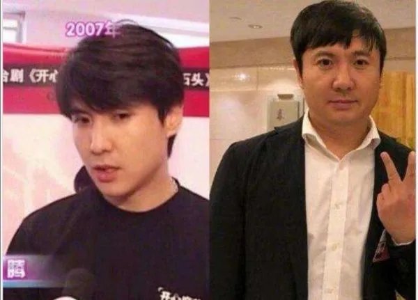 减肥对颜值有多大影响