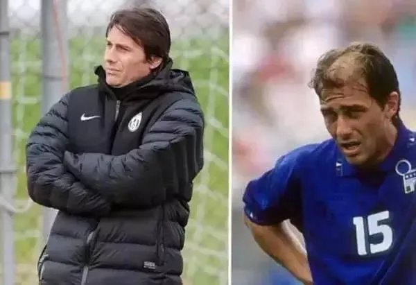 鲁尼植发大概花了多少钱？