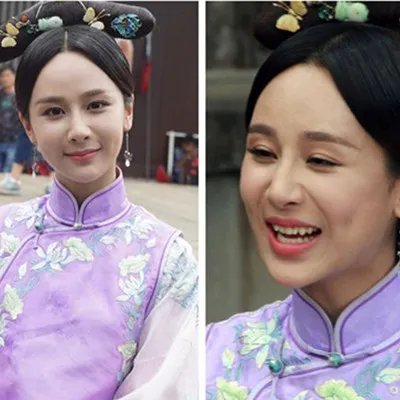 扒一扒杨紫的脸咋了 天妒红颜得荨麻疹面部红肿