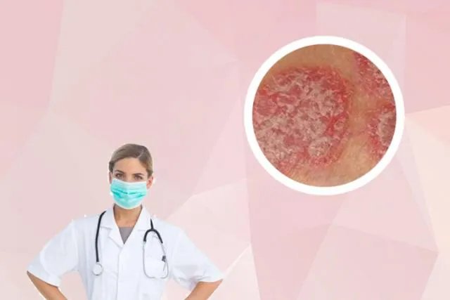 得癣的原因造成的