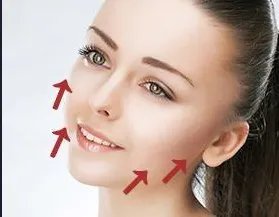 面部拉皮美容除皱术适合哪些人群？
