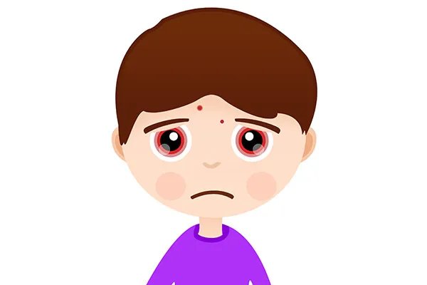 额头上长痘痘是什么原因