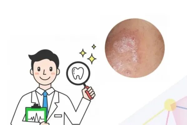 得癣的原因造成的