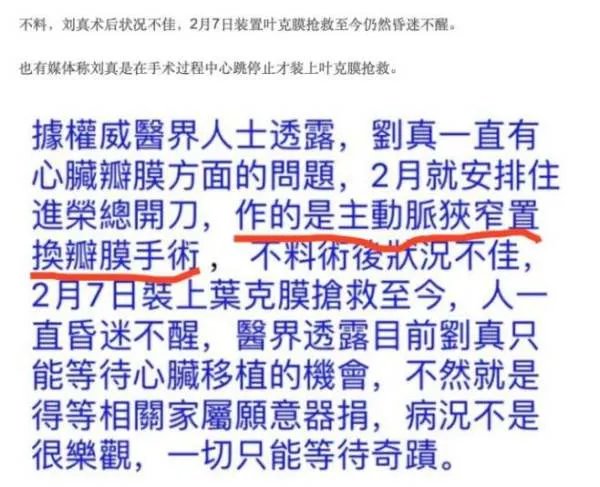 刘真什么原因走的？刘真手术为什么会出现意外
