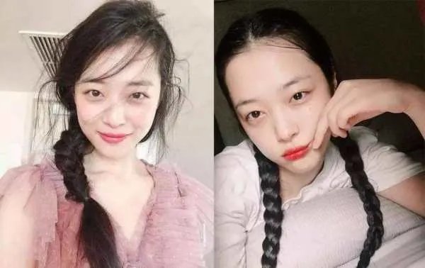 去眼角皱纹的方法什么方法最好