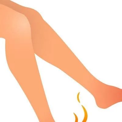 脚气是什么原因引起的