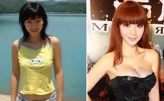 柳岩整容前后照片对比 网友大呼没有心理准备