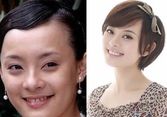 揭秘孙俪早年黑历史被曝光 整容前后照片遭起底