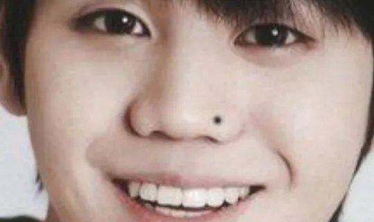 哪些痣是好痣？