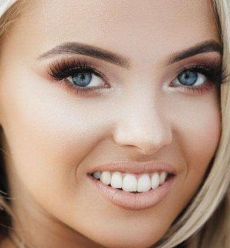 激光祛斑多少费用