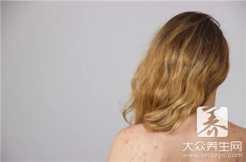 中药美白祛斑面膜配方介绍