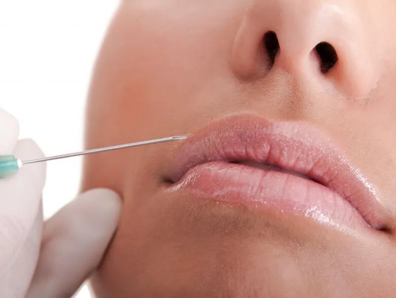 肉毒杆菌的副作用