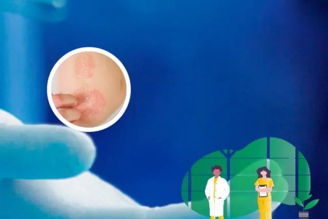 得癣的原因造成的