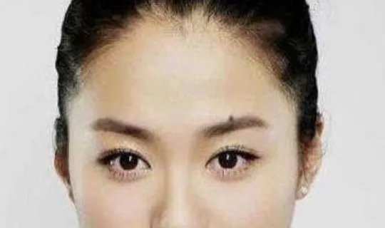 哪些痣是好痣？