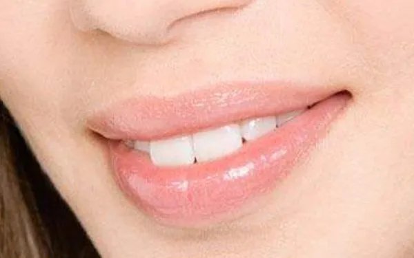 成年人矫正牙齿