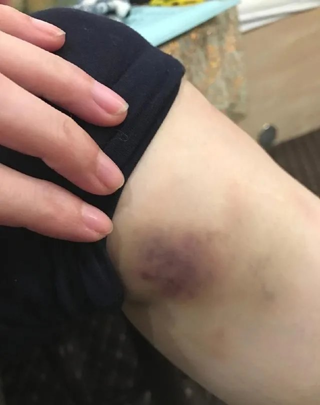 范冰冰穿长袖礼服领奖,背后的原因让人心疼?