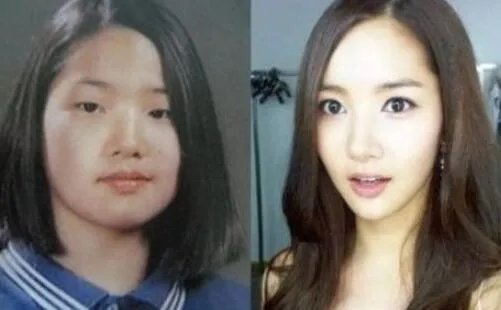 女星朴敏英整容前后惊人对比照，美出新高度（图）