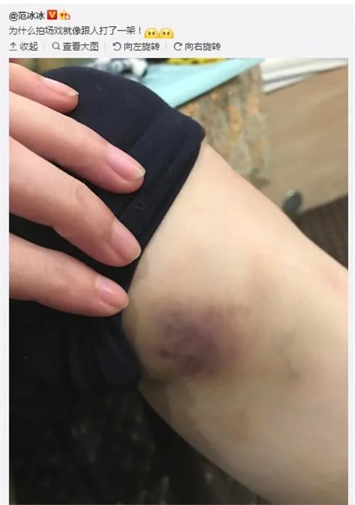 范冰冰穿长袖礼服领奖,背后的原因让人心疼?