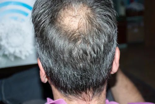 两性心理：偏离正轨的6种感情千万别碰!