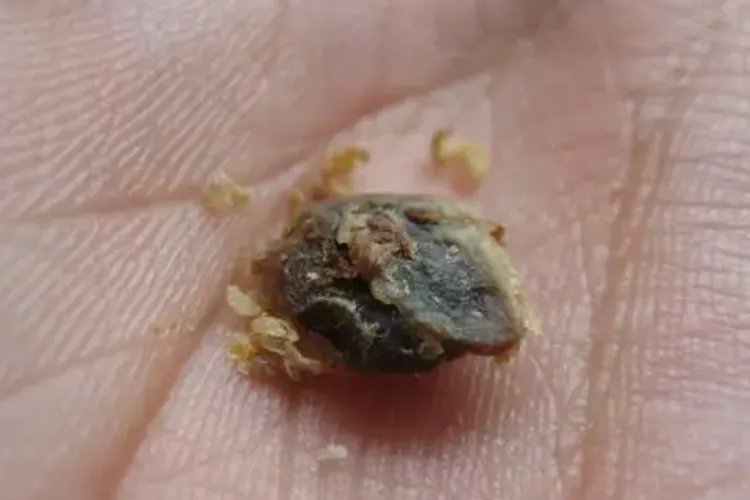 铁耳屎图片长什么样子