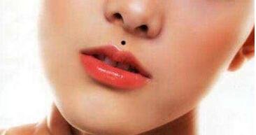 冷冻去痣医院哪里好