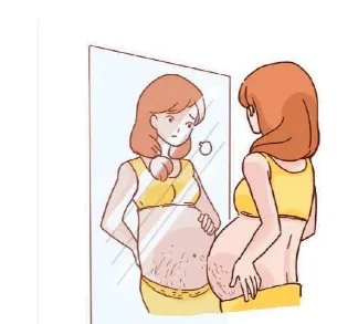 怎么就可以预防和治疗妊娠纹？