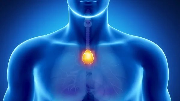 重症肌无力如何治疗