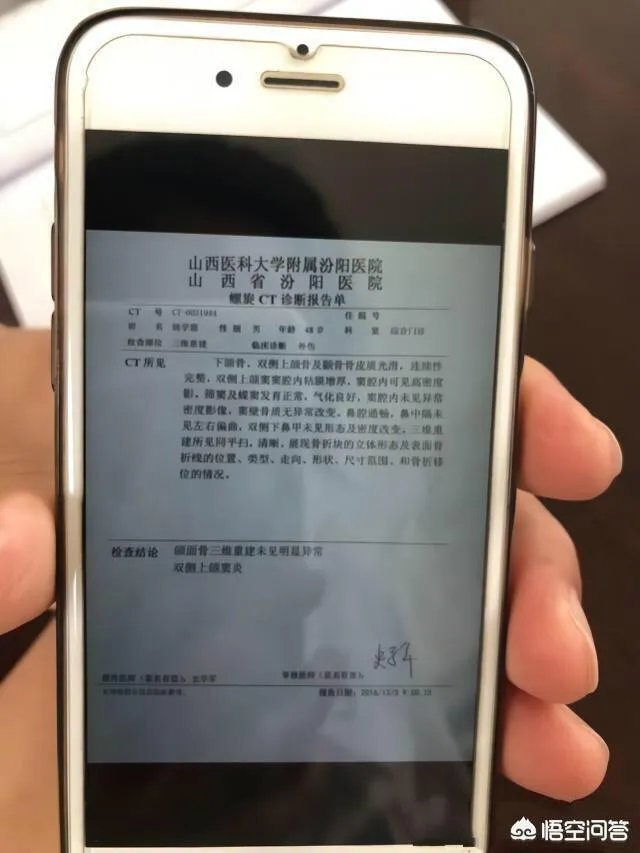 文水女子被无证酒驾司机撞死，丈夫扇肇事者耳光遭全国通缉；多机构伤情鉴定结论不一，丈夫刚解除取保候审。你怎么看？
