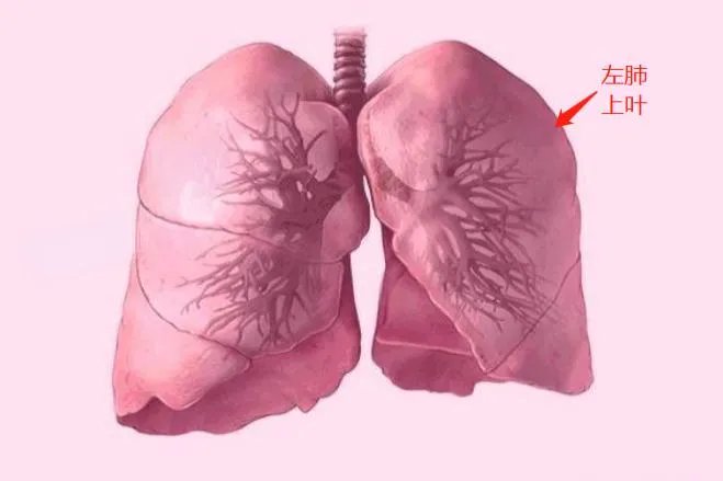 左肺上叶位置图