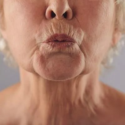 中医治疗青春痘的医院效果怎样