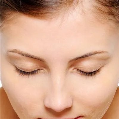 额头上长痘痘怎么办