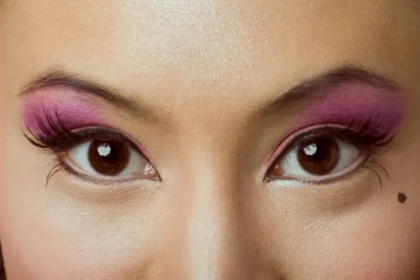 哪些痣是好痣？