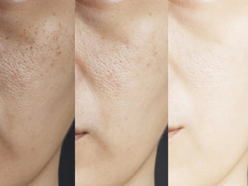 美容保健品有哪些