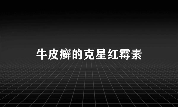 牛皮癣的克星红霉素