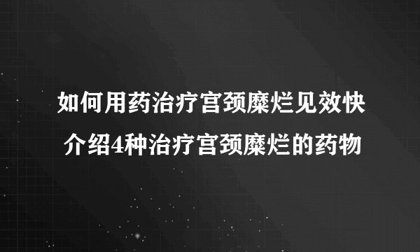 如何用药治疗宫颈糜烂见效快 介绍4种治疗宫颈糜烂的药物