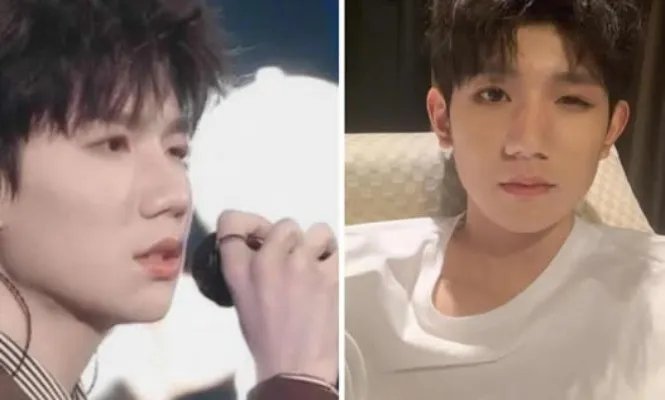 王源回应眼睛被咬具体什么情况：为什么被咬图片曝光