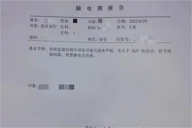 小儿正常脑电图报告单图片