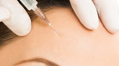 玻尿酸针有什么用