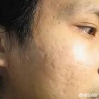 纯天然的护肤品牌都有哪些？