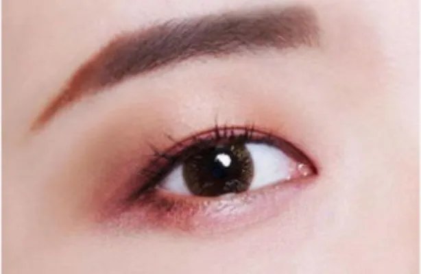 做开内眼角哪里做得好